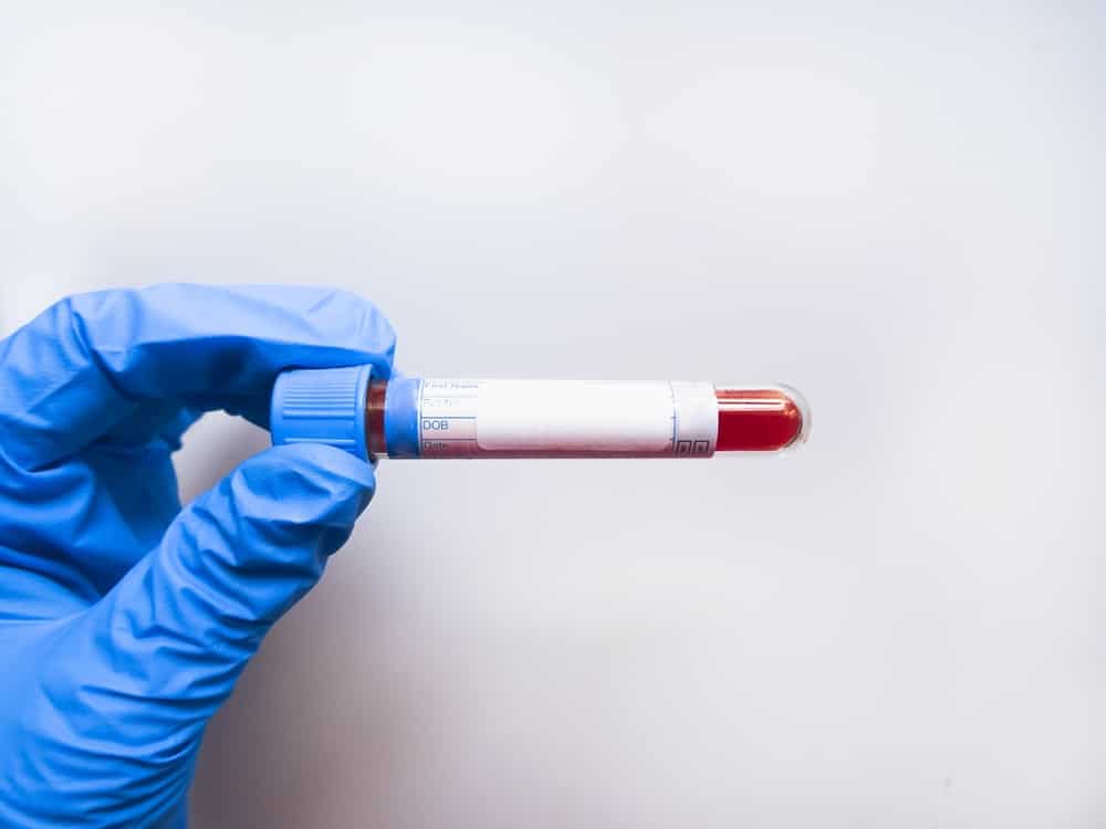 Microplastiche nel corpo umano: sono ovunque! La terrificante realtà