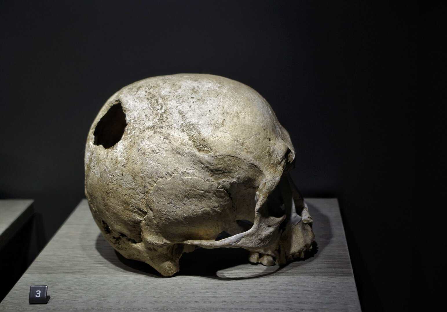 Area Megalitica di Aosta: Viaggio Nella Storia Antica