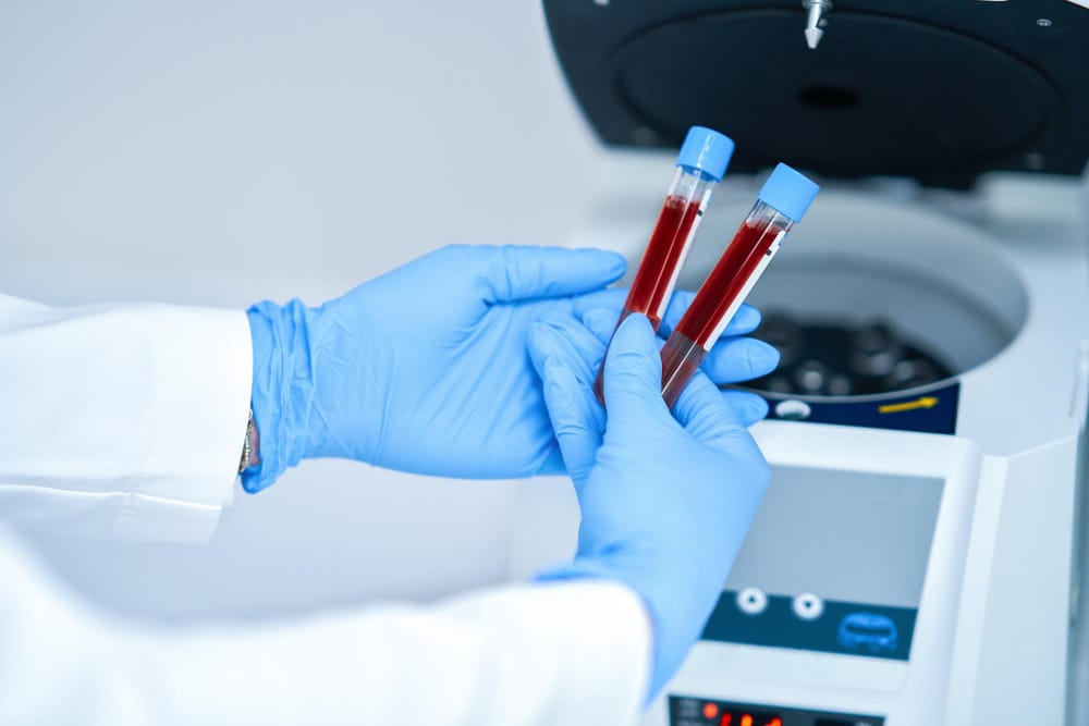 Un esame del sangue rivela quale organo invecchierà per primo