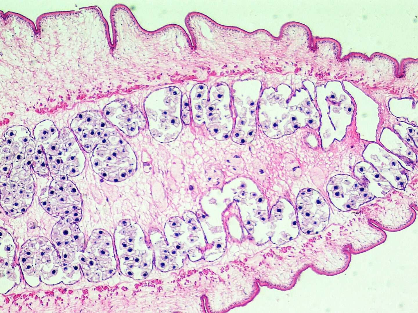 I vermi solitari infestano gli stomaci da almeno 99 milioni di anni