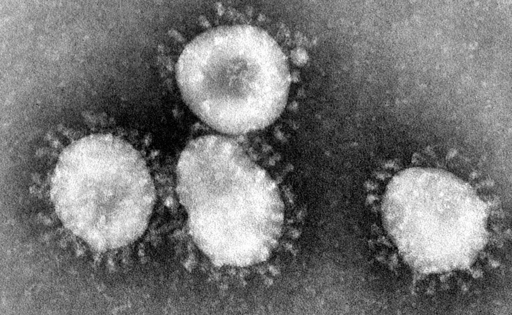 Scienziati scoprono nuovi nidovirus potenzialmente pandemici 24 Scienziati scoprono nuovi nidovirus potenzialmente pandemici
