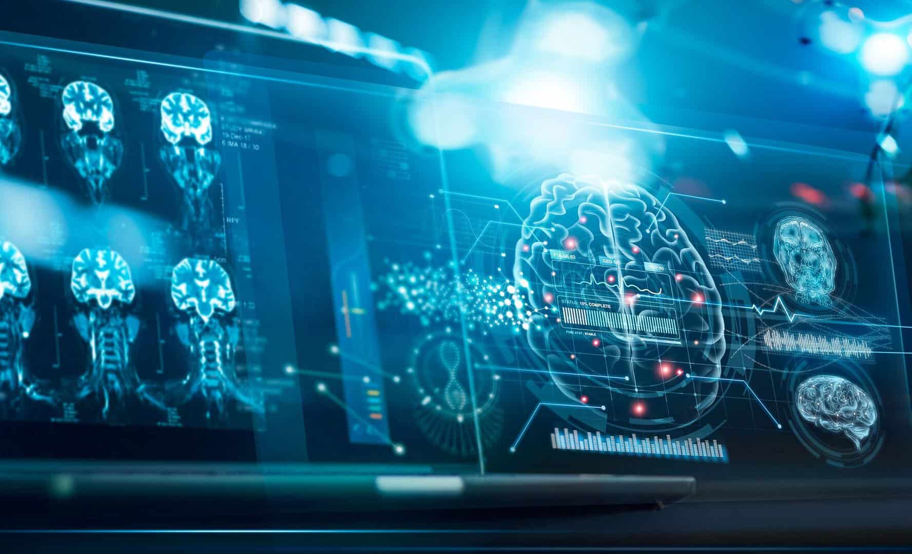 L’incredibile efficacia dell’intelligenza artificiale: accuratezza dell’82% nella previsione e diagnosi dell’Alzheimer