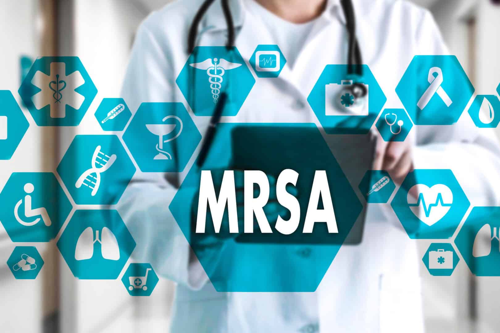 Scoperta vaccino MRSA: trovato modo promettente per combattere un batterio ultraresistente