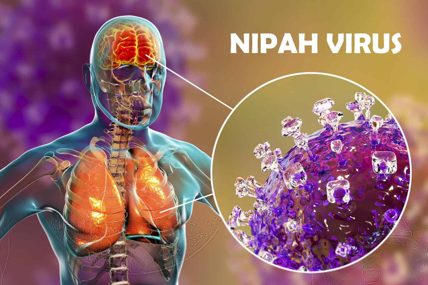 Il virus Nipah causa un decesso in India: è un pericolo a livello globale?