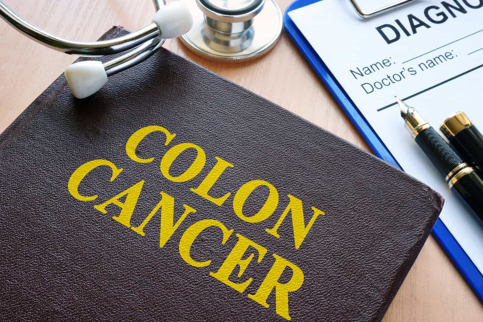 Prevenzione del cancro al colon: un semplice test casalingo può ridurre di un terzo il rischio di morte