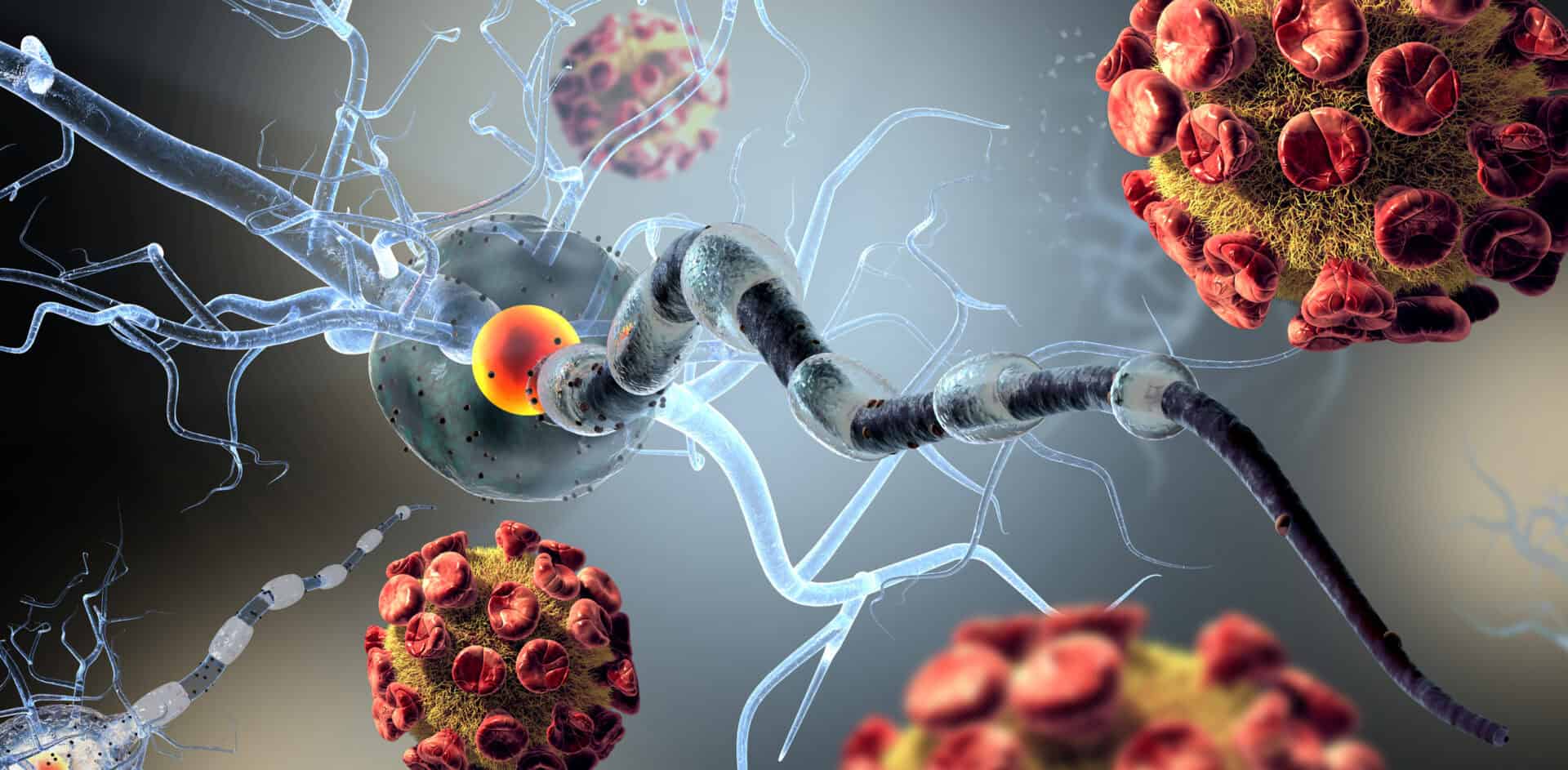La malattia da virus Oropouche: una nuova minaccia tropicale in Europa