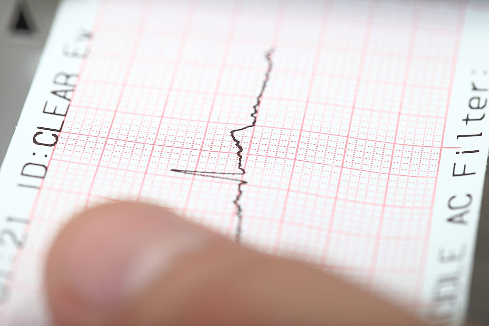 Terremoto ai Campi Flegrei: scossa di magnitudo 4.4, paura a Napoli